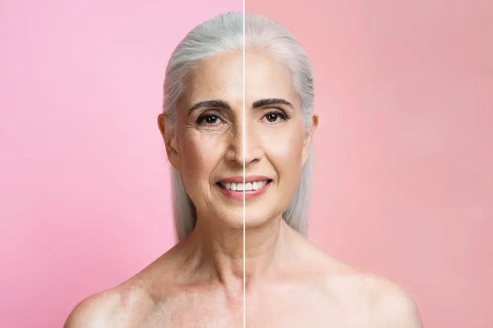 How to tighten sagging skin on the face