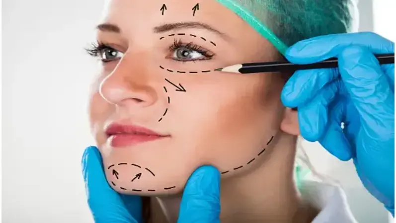 Face lift treatment on a woman's face