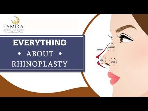 Rhinoplasty - Before & After