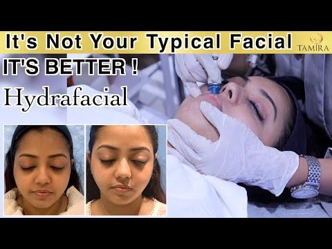 Hydra Facial - Before & After