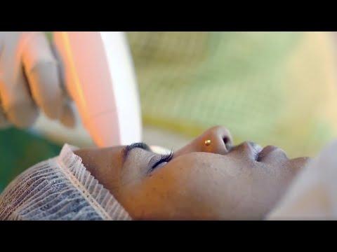 Laser Hair Removal - Before & After