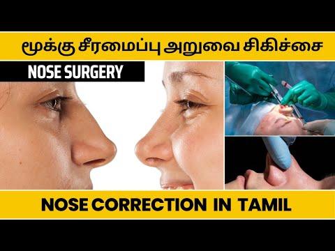 Rhinoplasty - Before & After