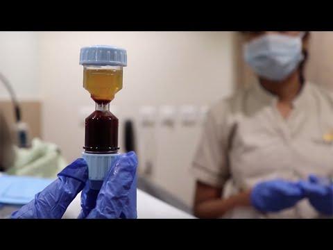 PRP Treatment - Before & After