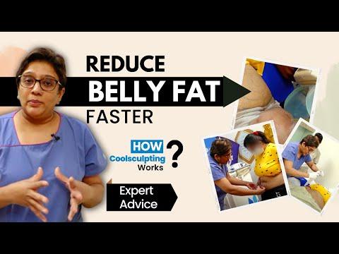 Coolsculpting - Before & After